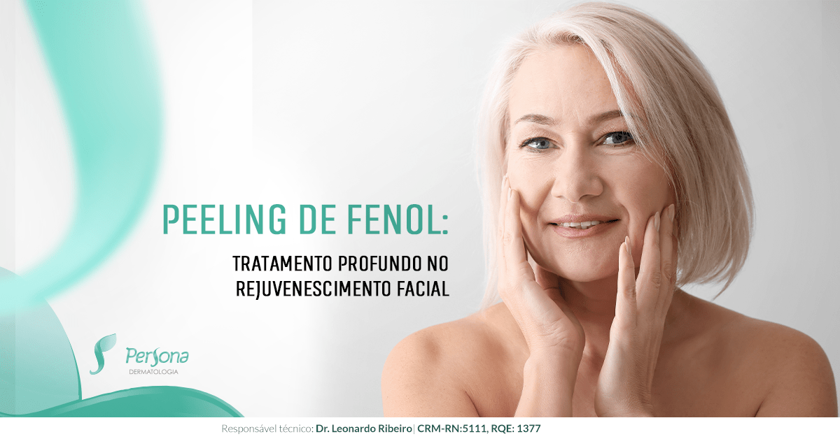 Peeling de fenol: tratamento profundo no rejuvenescimento facial - Persona  Dermatologia - Melhor Clínica de dermatologia de Natal - RN